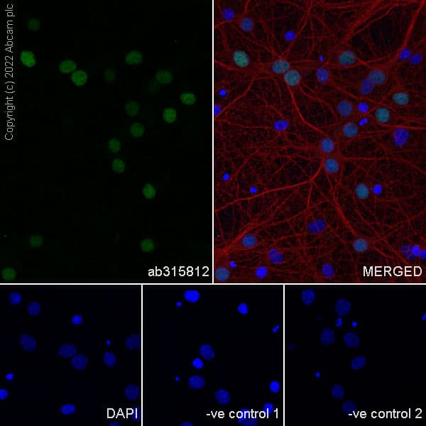 Anti-MATH2/NEUROD6 antibody [EPR28660-23](AB315812)