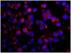 Arl15 Antibody Epr12591 Ab178425  Immunocytochemistry Immunofluorescence Img61855
