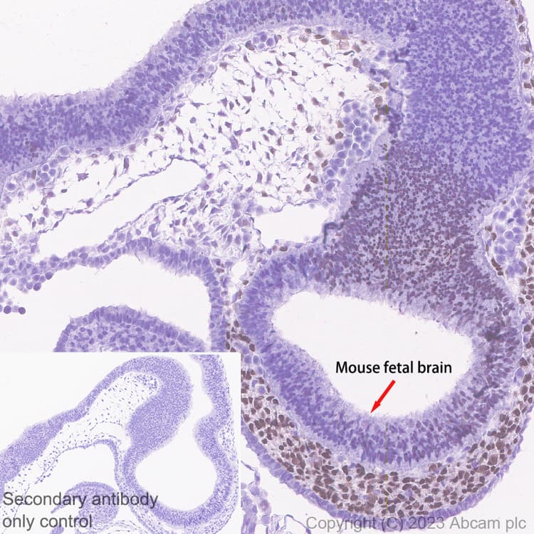 Arx Antibody Epr27481 32 Ab308260  Immunohistochemistry Formalin Pfa Fixed Paraffin Embedded Sections Img408869
