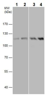 Anti-FAK (phospho Y576) antibody(AB226847)