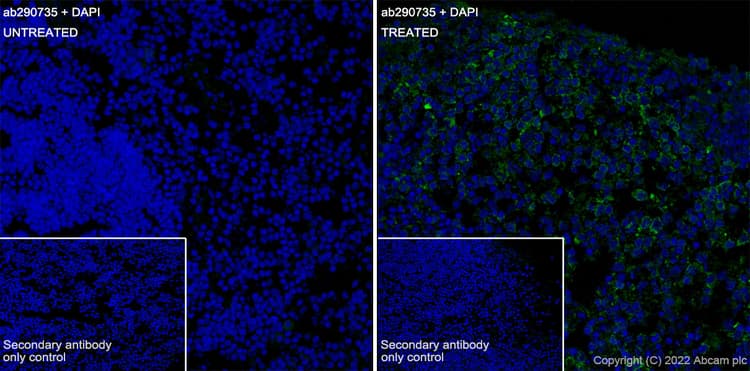 Anti-IL-6 antibody [EPR23819-103](AB290735)