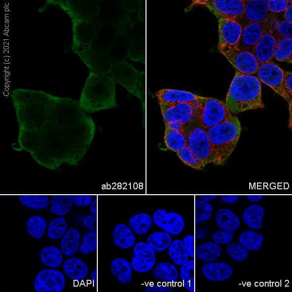 Hsp90 Alpha Antibody 68 Hsp90 Ab282108  Immunocytochemistry Immunofluorescence Img179141