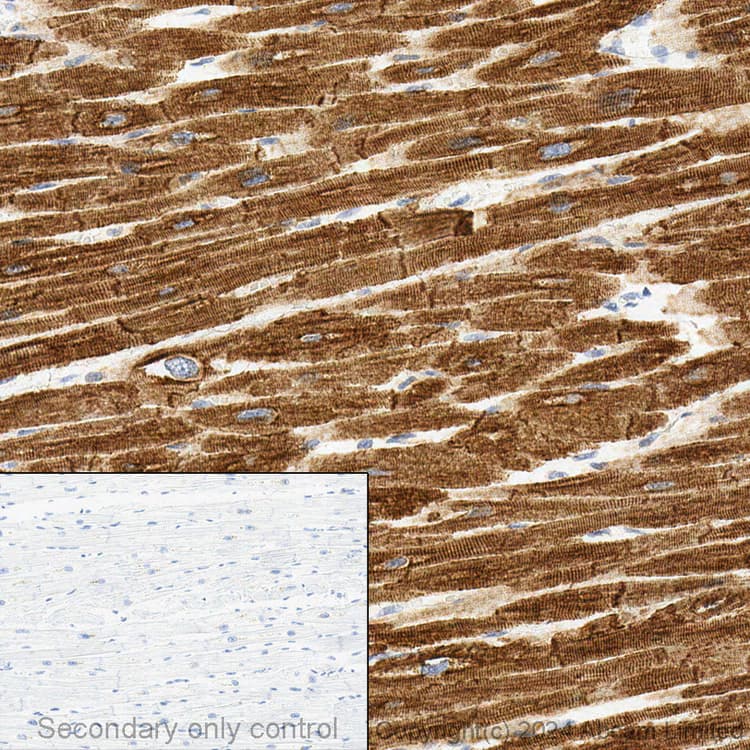 Anti-Desmin antibody - Cytoskeleton Marker(AB15200)