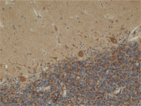 Anti-Pyruvate dehydrogenase E2/E3bp antibody [13G2AE2BH5](AB110333)