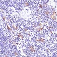 Anti-CD14 antibody [SP192](AB183322)