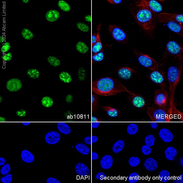 Goat Anti-Rat IgG H&L (Alexa Fluor® 488)(AB150157)