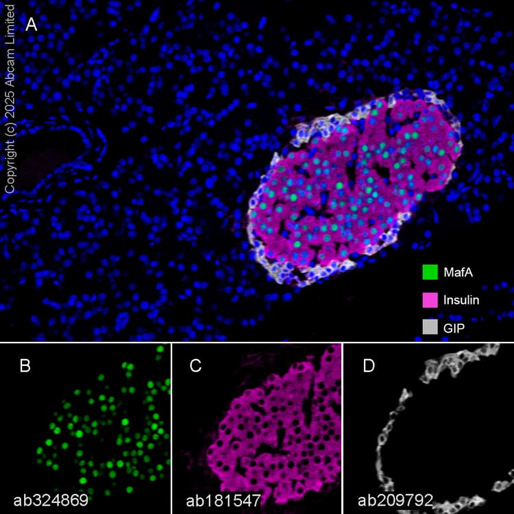 Anti-Insulin antibody [EPR17359](AB181547)