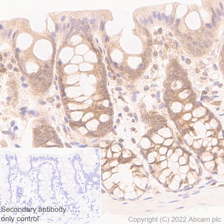 Smad2 Smad3 Antibody 18 Smad2 3 Bsa And Azide Free Ab305326  Immunohistochemistry Img406157