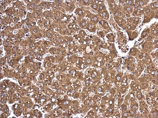 Argonaute 2 Antibody Ab226943  Immunohistochemistry Formalin Pfa Fixed Paraffin Embedded Sections Img119175