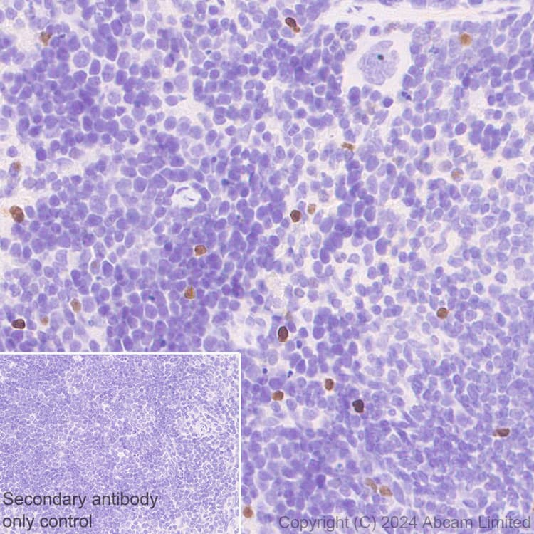 Anti-TBR2 / Eomes antibody [RM2055](AB319166)
