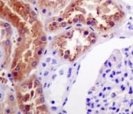 Anti-Klotho antibody [EPR6856](AB181373)