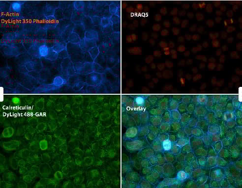 Anti-Calreticulin antibody - ER Marker(AB2907)