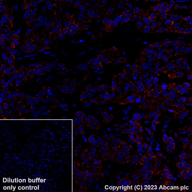 Alexa Fluor 647 Mthfd2 Antibody Epr26938 20 Ab314930  Immunohistochemistry Formalin Pfa Fixed Paraffin Embedded Sections Img422266