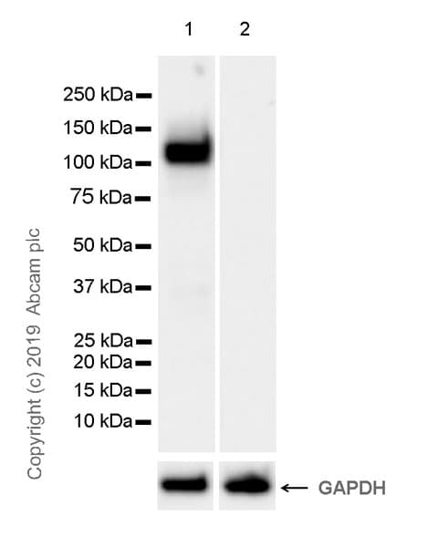 Anti-Ctip2 antibody [EPR23120-25](AB240636)