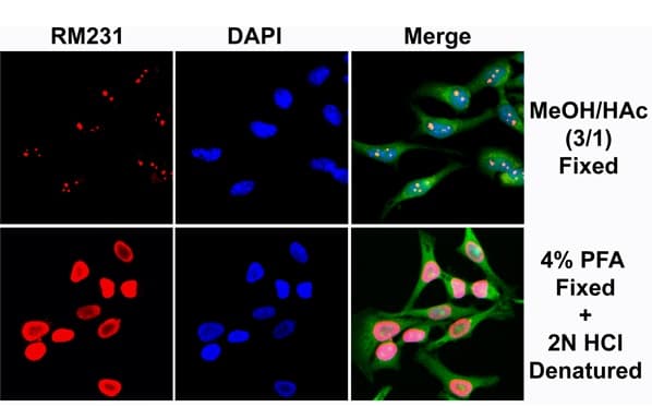 Anti-5-methylcytosine (5-mC) antibody [RM231](AB214727)