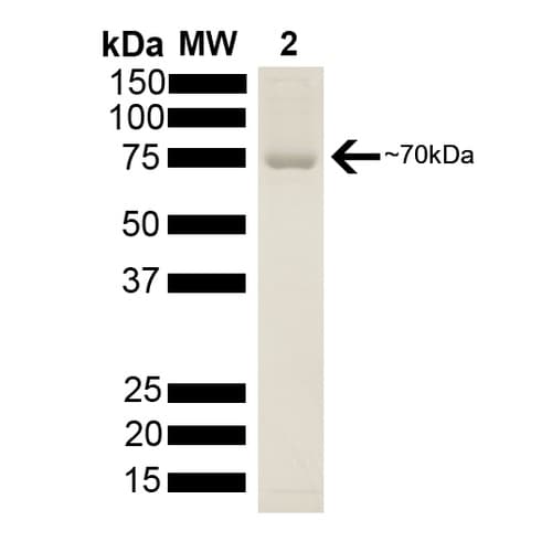 Recombinant human Hsp70 protein(ab78427)
