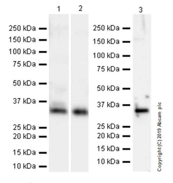 Anti-Collagen I antibody [EPR22894-89](ab260043)