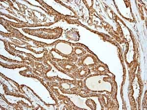 Anti-Calreticulin antibody [EPR3924] - ER Marker(AB92516)