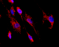 Anti-HADHA + HADHB antibody [4A8BG12](AB110302)