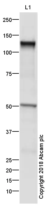Anti-VE Cadherin antibody - Intercellular Junction Marker(AB33168)