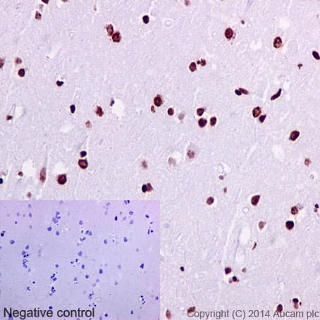 Anti-SATB2 antibody [EPNCIR130A] - BSA and Azide free(AB212177)