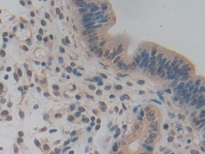 Anti-Pericentrin 1/FROUNT antibody(AB231958)