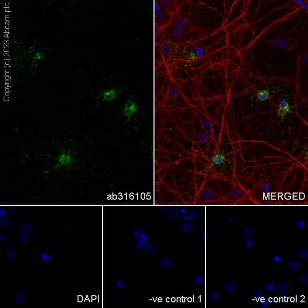 Anti-GPCR GPR17 antibody [EPR26423-34](AB316105)