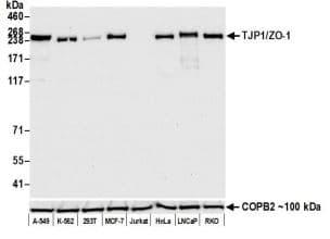 Anti-ZO1 tight junction protein antibody [BLR092G](AB276131)