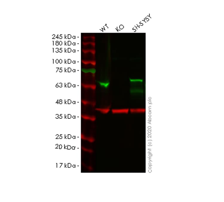 Alpha Internexin Antibody Ep676y Ab40758  Western Blot Img5840
