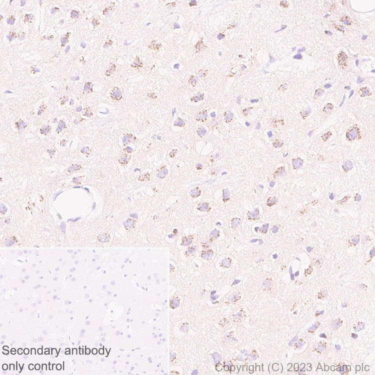Anti-KIAA0319L antibody [EPR28329-62](AB315027)