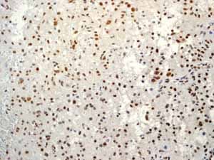 Sumo 1 Antibody Ep298 Bsa And Azide Free Ab248491  Immunohistochemistry Formalin Pfa Fixed Paraffin Embedded Sections Img112856