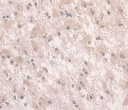 Hemojuvelin Antibody C6 Ab239495  Immunohistochemistry Formalin Pfa Fixed Paraffin Embedded Sections Img87720