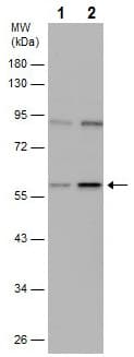 Ifit1 Antibody Ab229083  Western Blot Img62494
