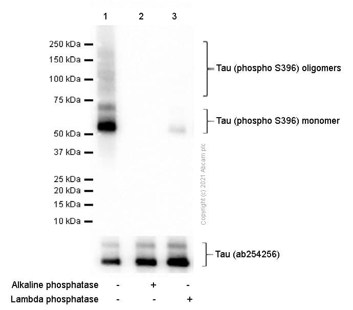 Anti-Tau (phospho S396) antibody [E178](ab32057)