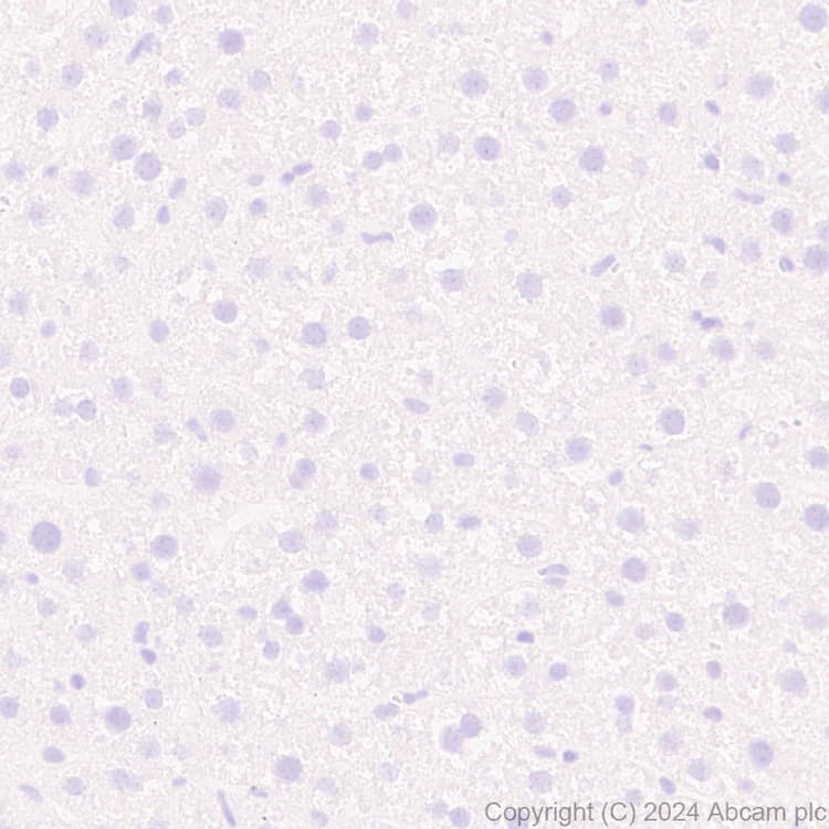 Anti-VAChT antibody [EPR29154-71](AB317452)