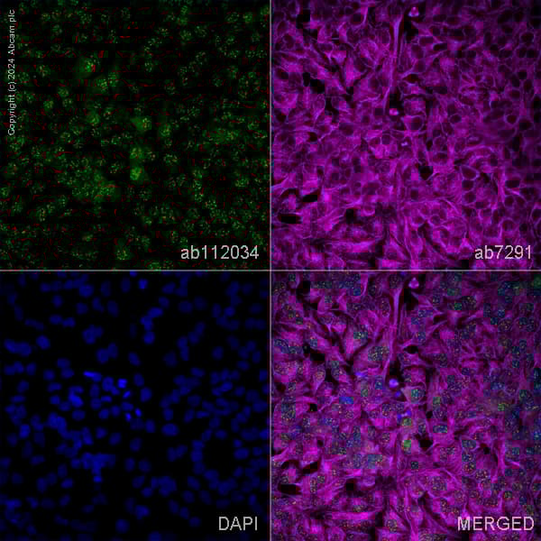 Anti-Cyclin D3/CCND3 antibody(AB112034)