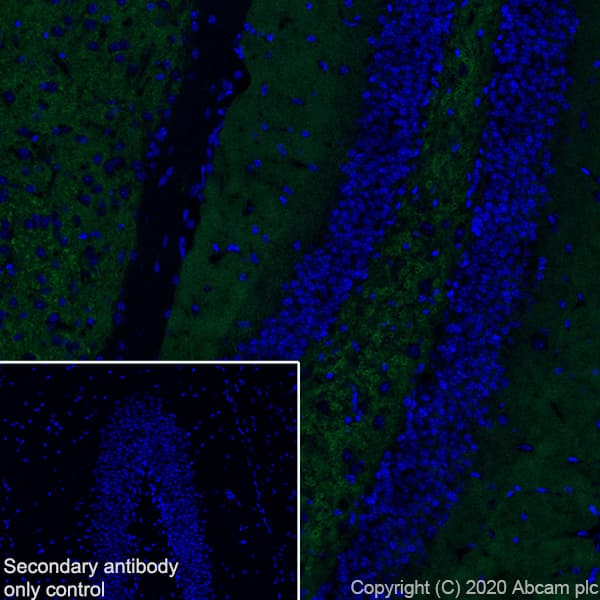 Anti-SYT2 + SYT1 antibody [EPR23920-2](AB259977)