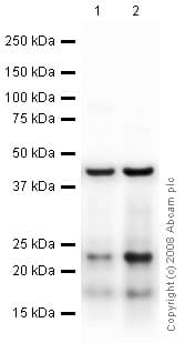 Anti-Myelin Basic Protein antibody(AB40390)
