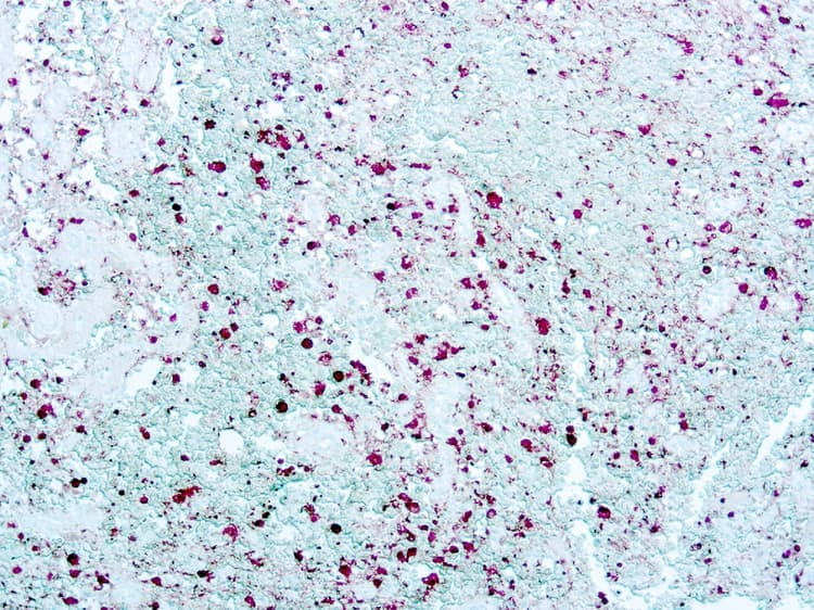 Anti-S100 antibody [4C4.9](AB4066)