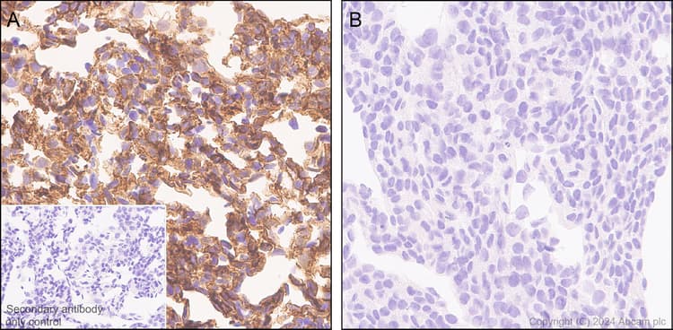 Anti-Claudin 1 antibody [RM1186](AB317709)