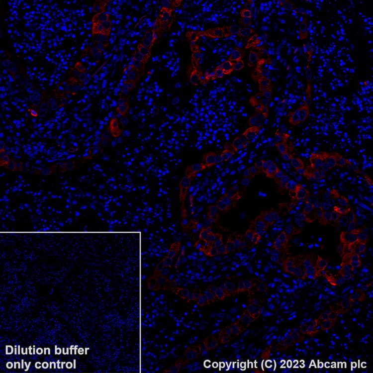 Alexa Fluor® 647 Anti-LINE-1 ORF1p antibody [EPR22227-6](AB314927)