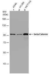 Anti-beta Catenin antibody - ChIP Grade(AB227499)