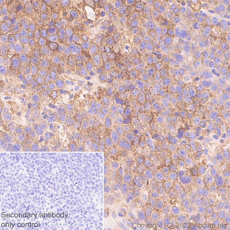 Anti-HLA-C antibody [EPR26121-73](AB307361)