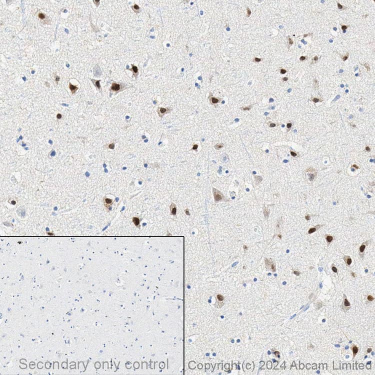 Anti-SATB2 antibody [EPNCIR130A] - BSA and Azide free(AB212177)