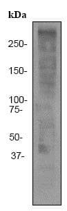 Anti-Ki67 antibody [EPR3610](AB92742)