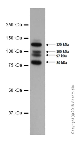 Anti-E Cadherin antibody [EP700Y] - Intercellular Junction Marker(AB40772)