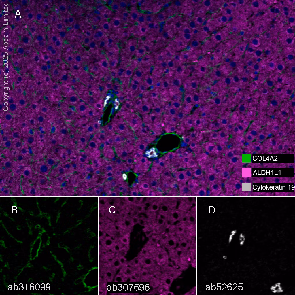 Cytokeratin 19 Antibody Ep1580y Cytoskeleton Marker Ab52625 Multiplex Immunohistochemistry Img447126