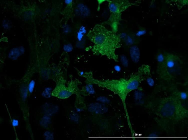 Anti-EAAT1 antibody(AB235203)