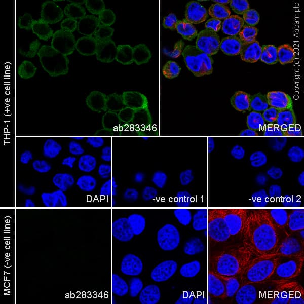 Anti-Iba1 antibody [EPR16589] - Rat IgG2a (Chimeric)(AB283346)