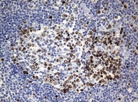 Anti-Ki67 antibody [OTI5D7](AB156956)